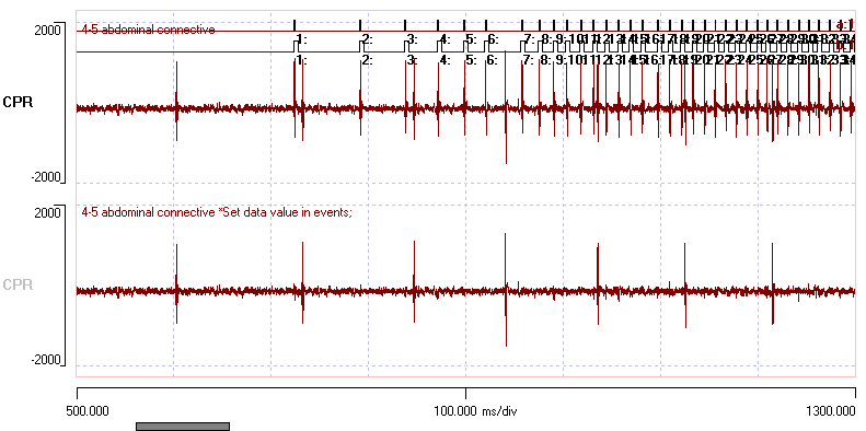 Remove waveforms that match the template